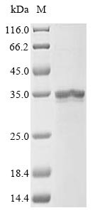 Diacylglycerol O-acyltransferase 1 (DGAT1), partial, human, recombinant