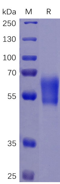 Human PD-1 Protein, hFc-His tag