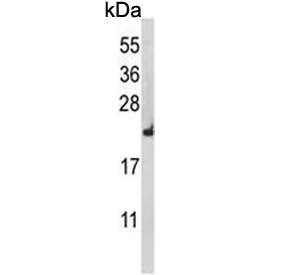 Anti-RPL18A