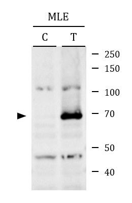 Anti-phospho-RIPK1 / RIP1 (Ser166), clone YJY-1-5