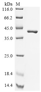 Glutathione S-transferase Mu 1 (Gstm1), partial, mouse, recombinant