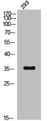 Anti-Phospho-NFKBIB (T19)