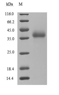 SARS coronavirus Spike glycoprotein (S), partial (Active), human, recombinant