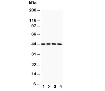 Anti-SIRT3