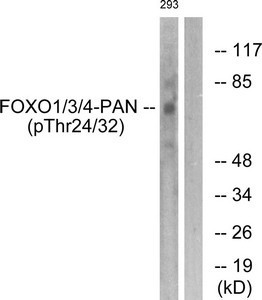 Anti-Phospho-FOXO1/FOXO3/FOXO4 (Thr24/32)