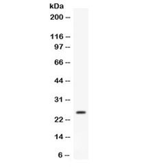 Anti-APOA1 / Apolipoprotein A I