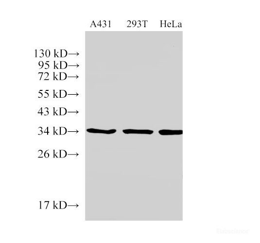 Anti-ANXA5