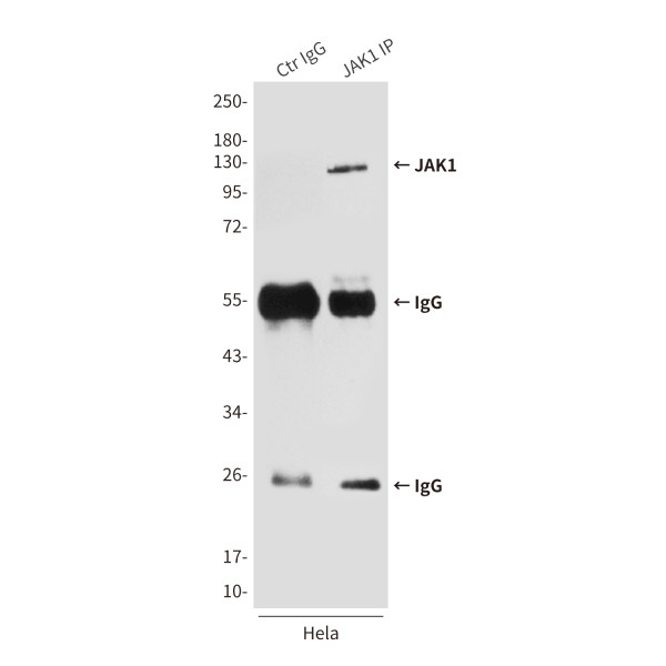 Anti-JAK1