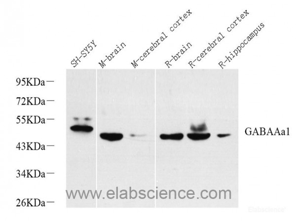 Anti-GABAA Receptor alpha1