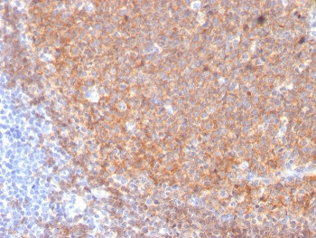 Anti-CD19 / B-lymphocyte marker, clone CD19/3117