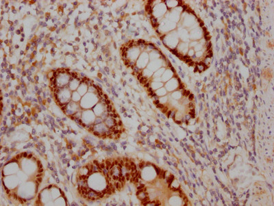 Anti-SOX9 Recombinant Monoclonal, clone 5H12