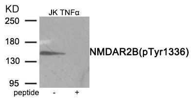 Anti-Phospho-GRIN2B (Tyr1336)