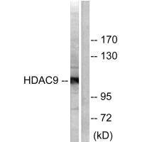 Anti-HDAC9