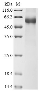 Double-stranded RNA-specific adenosine deaminase (ADAR), partial, human, recombinant