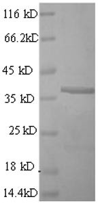 CD63 antigen (Cd63), partial, mouse, recombinant