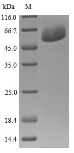 Tryptophan--tRNA ligase, cytoplasmic (WARS), human, recombinant