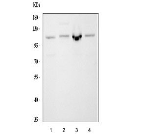 Anti-CBL / Casitas B-lineage lymphoma proto-oncogene