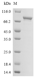 HLA class II histocompatibility antigen gamma chain (CD74), partial, human, recombinant