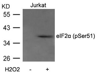 Anti-Phospho-EIF2S1 (Ser51)