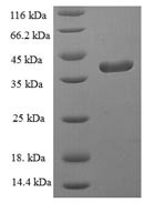 Glutathione peroxidase 1 (GPX1) (U49S), human, recombinant