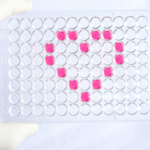 Human Eosinophil peroxidase (EPX) ELISA Kit