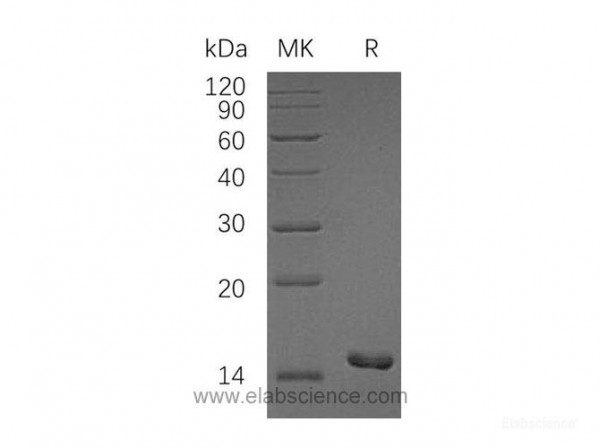 Camp Dependent Protein Kinase Inhibitor Ss Pki Ss Protein N 6his Recombinant Human Elabscience Biomol Com