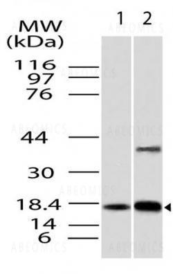 Anti-ACP1