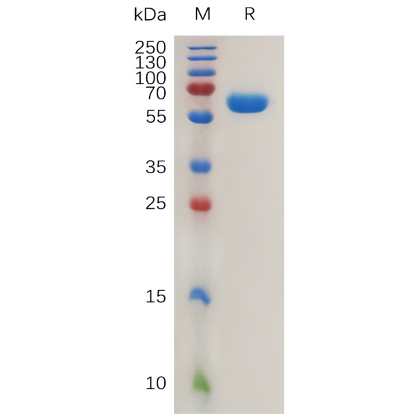 Human CA12 Protein, hFc Tag