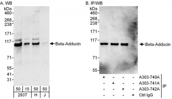 Anti-Beta-Adducin