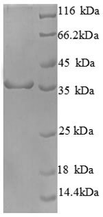 Cyclin-dependent kinase 4 (CDK4), human, recombinant