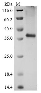 C5a anaphylatoxin chemotactic receptor (C5AR1), human, recombinant