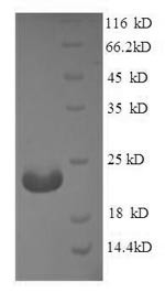 Angiopoietin-like protein 8 (ANGPTL8), human, recombinant