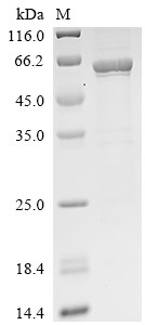 Acetyl-CoA carboxylase 1 (ACACA), partial, human, recombinant