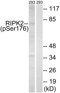 Anti-Phospho-RIPK2 (Ser176)