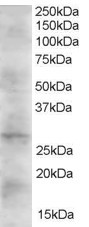 Anti-DKK2, C-terminal