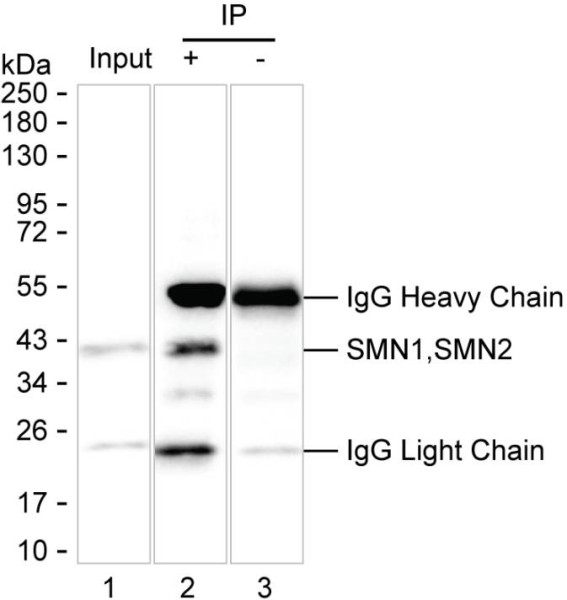 Anti-SMN1 Recombinant