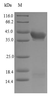 Estrogen receptor beta (ESR2), partial, human, recombinant