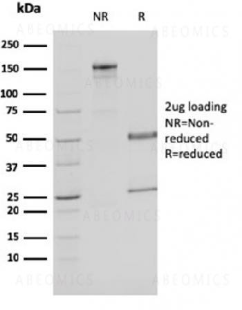 Anti-Malate dehydrogenase 1 NAD (soluble) Monoclonal Antibody (Clone: CPTC-MDH1-1)