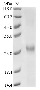 Cathepsin B (CTSB), partial, human, recombinant