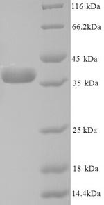 Annexin A5 (ANXA5), human, recombinant