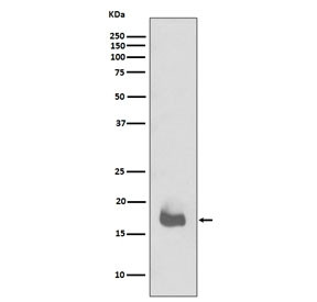 Anti-IL1 beta / IL1B, clone IBF-9
