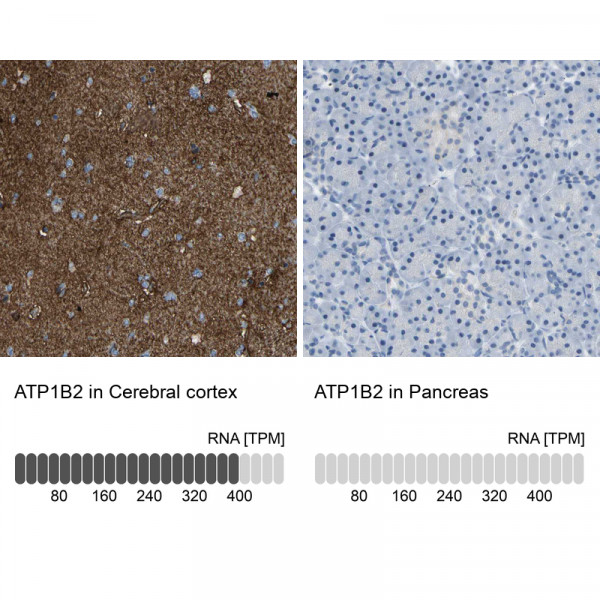 Anti-ATP1B2