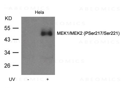 Anti-phospho-MEK1/MEK2 (Ser217/Ser221)