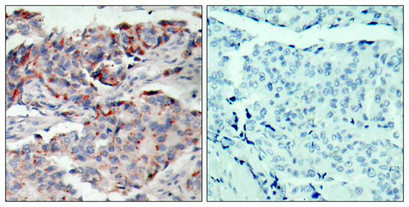 Anti-Phospho-JAK2 (Tyr221)