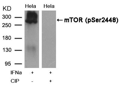 Anti-Phospho-MTOR (Ser2448)