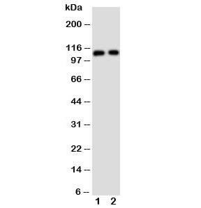 Anti-TRPC6