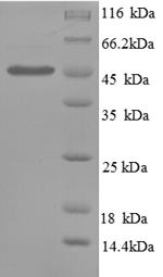 Plasminogen activator inhibitor 1 (SERPINE1), partial, human, recombinant