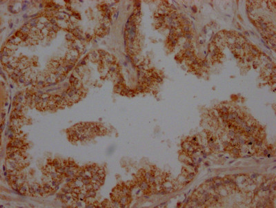 Anti-PLAU Recombinant Monoclonal, clone 10E5