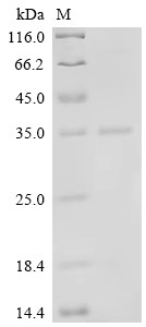 Vascular endothelial growth factor A (VEGFA), human, recombinant