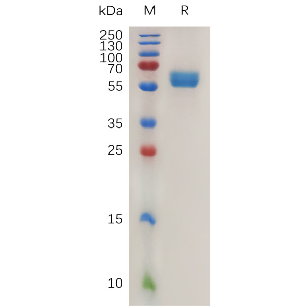 Mouse 4-1BB Ligand Protein, hFc Tag